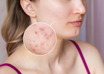 Why use an Online Dermatologist for your Skin Condition