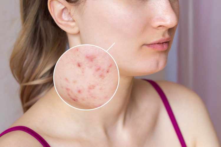Why use an Online Dermatologist for your Skin Condition