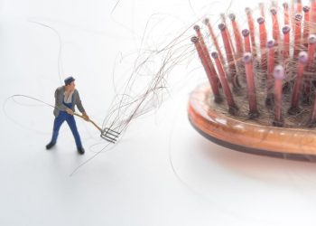 Follicular Unit Extraction: A Modern Solution for Hair Loss