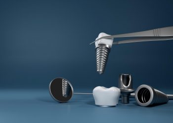 Can you get dental implants on NHS?
