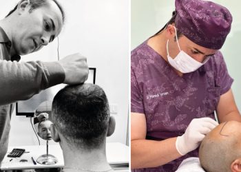 Transforming Lives: Exploring the Journey of Hair Transplantation in Turkey with Dr. Resul Yaman