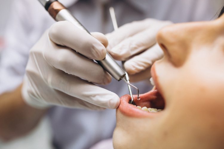 Looking for a Dentist in Melbourne CBD? Here’s What You Should Know