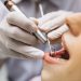 Looking for a Dentist in Melbourne CBD? Here’s What You Should Know