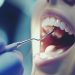 Protect Your Smile with Dental Sealants: Insights from Greenville Dentists