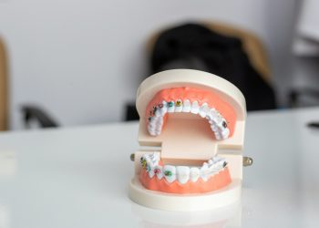 A Comprehensive Guide to Getting Braces in Greenville, NC