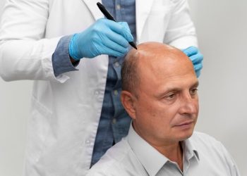 Transform Your Hairline: The Best Turkey Hair Transplant Before and After