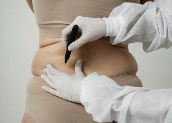 CoolSculpting in Melbourne: The Revolutionary Non-Surgical Fat Reduction Treatment
