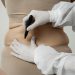 CoolSculpting in Melbourne: The Revolutionary Non-Surgical Fat Reduction Treatment