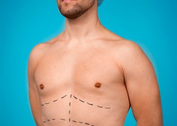 Mesofat: The Future of Non-Surgical Fat Reduction