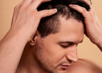 SMP London: Redefining Confidence with Scalp Micropigmentation