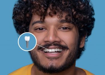 Do You Have to Go Without Teeth Before Getting Implants? Debunking Common Myths About the Dental Implant Process