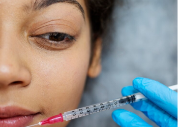 Rejuvenating the Aging Lip: How Fillers Can Restore Lost Volume and Smooth Vertical Lines