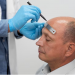 Hair Transplant in Turkey: Why Istanbul Became the World’s Leading Destination for Hair Restoration