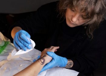 When Ink Fades: Understanding Tattoo Removal Through a Holistic Lens