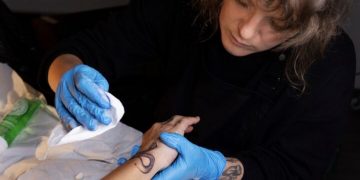 When Ink Fades: Understanding Tattoo Removal Through a Holistic Lens