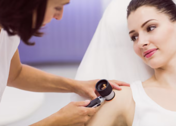 Why Do People Choose Mole Removal? Understanding the Reasons Behind Treatment
