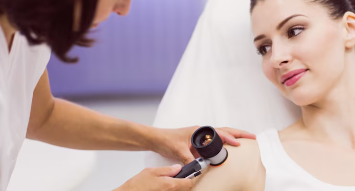Why Do People Choose Mole Removal? Understanding the Reasons Behind Treatment